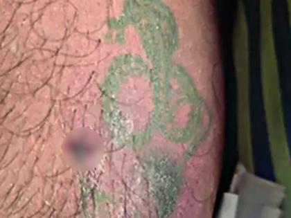 What an unfortunate coincidence! Bhopal man bitten by cobra on ‘Nagin’ tattoo, dies | हा कसला दुर्देवी योगायोग! युवकाच्या ज्या हातावर होता नागाचा टॅटू, त्याचठिकाणी...