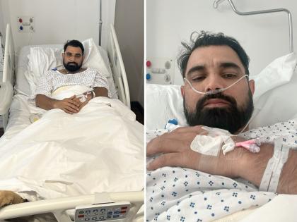 Mohammed Shami underwent surgery for Achilles tendon in London on Monday, set to miss IPL 2024 | लंडनच्या हॉस्पिटलमध्ये उपचार घेतोय मोहम्मद शमी; भावनिक पोस्ट; म्हणाला, स्वतःच्या पायावर... 