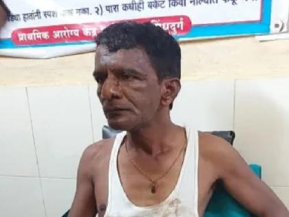 Uddhav Thackeray group worker brutally beaten in Sherpe sindhudurg | Sindhudurg: शेर्पे येथील उद्धवसेनेच्या कार्यकर्त्याला बेदम मारहाण