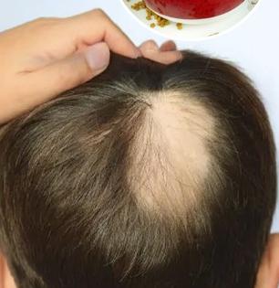 लहान मुलांचेही केस खूप गळू लागले? जावेद हबीब सांगतात मुलांच्या नाजुक केसांसाठी सोपा उपाय