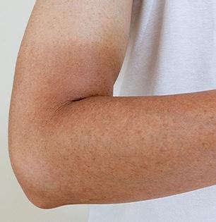 हातापायांसह चेहर्‍यावरचे केस आणि टॅनिंग कमी करण्याचे ५ नैसर्गिक उपाय, रेझरची गरजच नाही