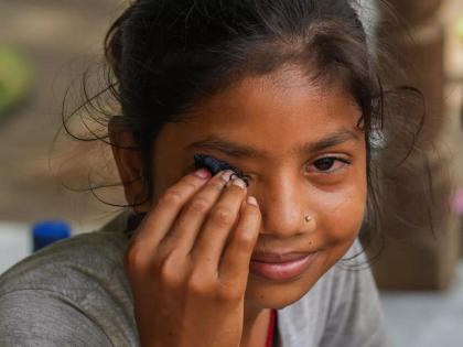 An epidemic of eye dropsy spreads in Nashik; Many school children affected | नाशिकमध्ये पसरते डोळे येण्याची साथ; अनेक शाळकरी मुले बाधित