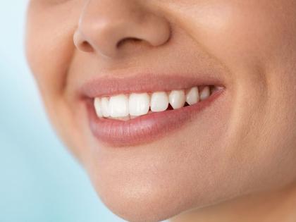 Keep your smile, toothpaste will now be filled with home remedies | तुमचं हसू कायम ठेवा, दाताच्या फटी आता भरतील घरगुती उपायांनी