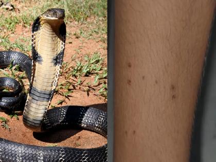 VIDEO: 15-year-old girl was chased by a snake; bitten 6 times in a month; terror in the village | VIDEO: १५ वर्षीय मुलीच्या मागे साप लागला; एका महिन्यात ६ वेळा चावला; गावात दहशत...