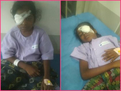 11 year old snehal from Adivasi Pada got sight motibindu pune latest news in marathi | अंगारे, धुपाऱ्यापासून मुक्ती; आदिवासी पाड्यातल्या ११ वर्षांच्या स्नेहलला मिळाली दृष्टी