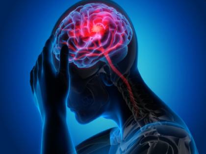 Be careful! Increasing brain stroke at a young age; Life can be lost if not treated in time | सावधान! तरुण वयात वाढतोय ब्रेन स्ट्रोक; वेळीच उपचार न मिळाल्यास जीव जाऊ शकताे