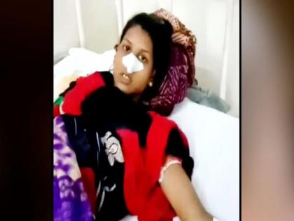 The woman troubled by the beating asked for alimony in the court, the angry husband cut nose | संतापलेल्या नवऱ्यानं दातानं कापलं बायकोचं नाक; दोघांमध्ये सुरु होता अनेक वर्ष वाद-विवाद