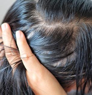केसात घाम साचतो-चिपचिपे होतात? ४ सोपे उपाय, घामाचा त्रास होईल कमी- केस होतील मऊसुत