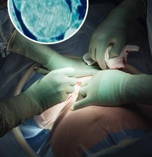 चार वर्षे सोसल्या पोटदुखीच्या असह्य वेदना, सिझेरियन करताना डॉक्टरांकडून झाली मोठी चूक-पोटात सापडलं भलतंच..