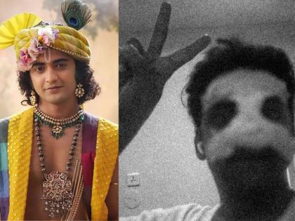 Sumedh Mudgalkar Suffers Nose Injury On Set Shares Health Update | प्रसिद्ध अभिनेत्याचा शूटिंगदरम्यान अपघात; नाकाचे हाड मोडले, आता कशी आहे प्रकृती?