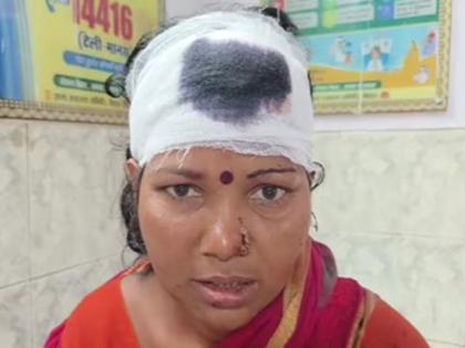 bihar supaul daughter in law beaten by mother in law and father in law for making reels | भयंकर! सुनेने रील बनवताच सासरच्या मंडळींना राग अनावर; संतापलेल्या सासऱ्याने फोडलं डोकं bihar supaul daughter in law beaten by mother in law and father in law for making reels | भयंकर! सुनेने रील बनवताच सासरच्या मंडळींना राग अनावर; संतापलेल्या सासऱ्याने फोडलं डोकं
