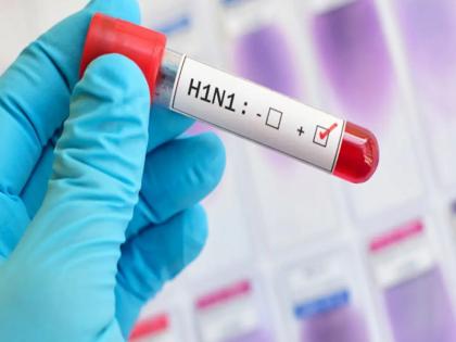 14 cases of swine flu in Pimpri Chinchwad; Patients found after three years | पिंपरी चिंचवडमध्ये स्वाईन फ्लूचे 14 रुग्ण; तीन वर्षांनंतर आढळले रुग्ण