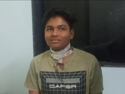 Child's neck injured due to nylon net, incident at Bhandara Lakhandur | पतंगाच्या नायलॉन मांजाने गळा चिरला; बालक गंभीर, लाखांदूर येथील घटना