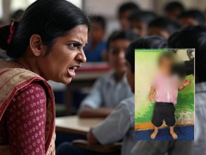 Four-year-old boy beaten for not reciting a poem; Case registered against teacher in Ulhasnagar | कविता म्हटली नाही म्हणून चार वर्षांच्या मुलास मारहाण; उल्हासनगरमध्ये शिक्षिकेवर गुन्हा दाखल