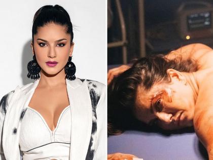 Fans were shocked to see a photo of Sunny Leone in a bloody state | रक्तबंबाळ अवस्थेतील सनी लिओनीचा फोटो पाहून चाहते पडले चिंतेत