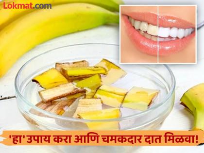 Use banana peel and baking soda for making teeth white at home naturally | पिवळ्या दातांना वैतागलात, केळीच्या सालीत 'ही' एक गोष्ट मिक्स करून लावा; चमकदार होतील दात!