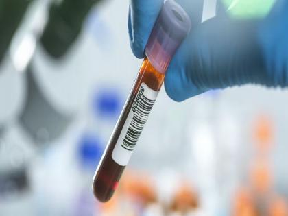 Why pay for blood test? Free check-up is going on at HLL's Mahalab | रक्तचाचणीला पैसे कशाला मोजता? ‘एचएलएल’च्या महालॅबमध्ये होतेय मोफत तपासणी Why pay for blood test? Free check-up is going on at HLL's Mahalab | रक्तचाचणीला पैसे कशाला मोजता? ‘एचएलएल’च्या महालॅबमध्ये होतेय मोफत तपासणी