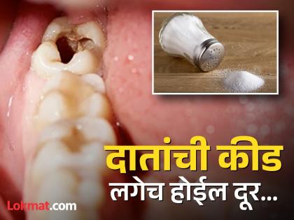 How to use garlic and salt for tooth cavity | मिठात 'ही' एक गोष्ट मिक्स करून दातांवर लावाल तर दूर होईल कीड आणि असह्य दुखणं!