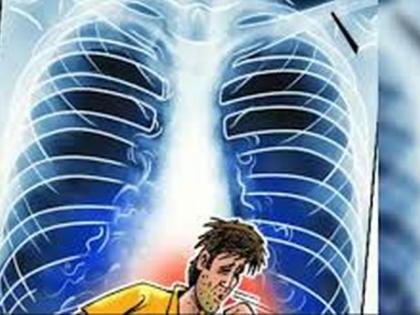 Towards Tuberculosis Eradication! | क्षयरोग निर्मुलनाच्या दिशेने वाटचाल!