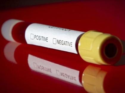 Addition of 54 positive patients in Yavatmal district | यवतमाळ जिल्ह्यात ५४ पॉझेटिव्ह रुग्णांची भर; ३७ जणांना सुट्टी