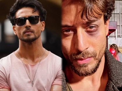 Tiger shroff injured his eye during the shoot of film ganapath part1 shared photo | शूटींगदरम्यान टायगर श्रॉफच्या डोळ्याला लागला मार, फोटो बघून चाहत्यांची वाढली चिंता