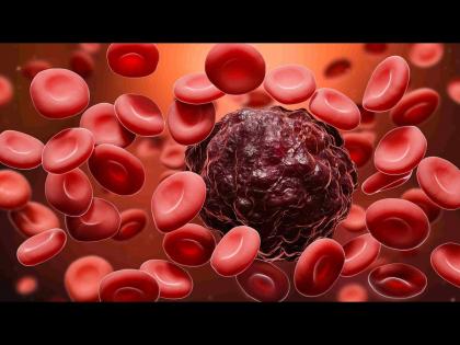 Early sign and symptoms of blood cancer or leukemia | ही छोटी छोटी लक्षण सांगतात वाढत आहे ब्लड कॅन्सरचा धोका, वेळीच व्हा सावध!