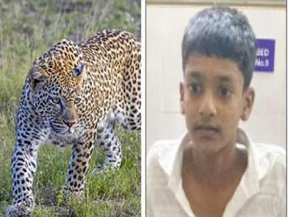 Leopard attack on speeding bike in Undale Satara district, boy injured   | Satara: धावत्या दुचाकीवर बिबट्याचा हल्ला, मुलगा जखमी  