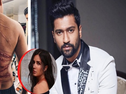 Vicky Kaushal Shares His Latest Photo From Movie Sardar Udham Showing Skin Cuts On His Back | विकी कौशलच्या पाठीवरचे वार अन् चाहते कतरिनाच्या काळजीने बेजार; 'कमजोर दिल'वाल्यांनो पाहूच नका!