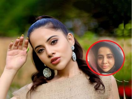 uorfi javed shared horrible picture saying when allergies hit Urfi Javed | Urfi Javed : अरेरे, उर्फी जावेदची ही काय अवस्था...? ॲलर्जीनं अख्खा चेहराच बदलला...!