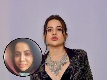 Swollen face..., fans were shocked to see the condition of Urfi Javed | सुजलेला चेहरा, डोळ्याखाली डार्क सर्कल..., Urfi Javedची अवस्था पाहून चाहते झाले हैराण