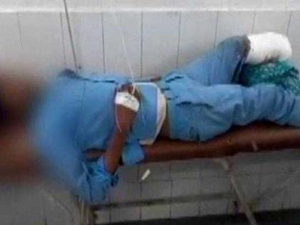 Shocking incident UP Doctors Use Man's Severed Foot As Headrest After His Surgery | संतापजनक! तुटलेला पायच डोक्याखाली उशीसारखा वापरला, डॉक्टरांच्या असंवेदनशिलतेने सारेच हादरले