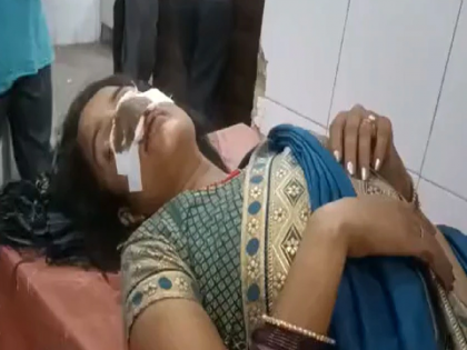 UP Crime: angry husband bites wife's nose and beat her, police filed FIR | UP Crime: धक्कादायक! पत्नी माहेरी गेल्याने पती नाराज, मारहाण करत पत्नीच्या नाकाचे तोडले लचके