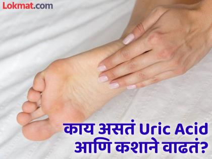 These symptoms seen in feet indicate high uric acid | रक्तात Uric Acid वाढल्यावर पायांवर दिसतात हे ५ संकेत, सोबतच जाणून घ्या याची कारणे!