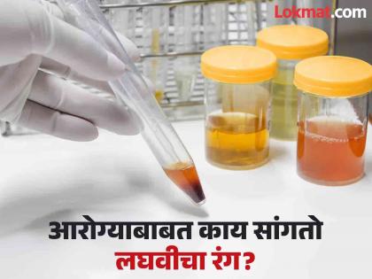 Urine colour change dangerous effects, symptoms, risk | लघवीच्या बदलत्या रंगाकडे दुर्लक्ष करणं पडू शकतं महागात, वाचा काय सांगतो लघवीचा रंग!