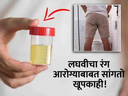 Urine colour change dangerous effects, symptoms risk disease | लघवीचा रंग बदलणं कधी असते धोक्याची घंटा? जाणून घ्या कसा रंग दिसल्यावर वाढू शकते चिंता!