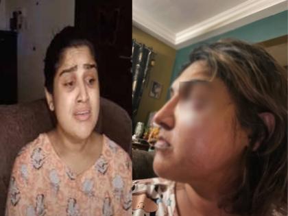 Bigg Boss Tamil fame contestant vanita vijaykumar faced fatal attack at night shared photo | 'बिग बॉस' फेम 'या' अभिनेत्रीवर जीवघेणा हल्ला, अन्य स्पर्धकाच्या सपोर्टरने कृत्य केल्याचा संशय