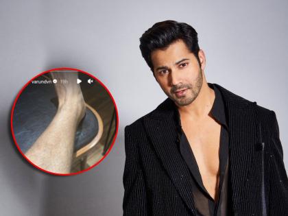 varun dhawan gets injured while VD 18 movie shooting shared photo of swollen leg | सिनेमाच्या शूटिंगदरम्यान वरुण धवन गंभीर जखमी, फोटो शेअर करत म्हणाला, "लोखंडाच्या खांबाला आपटल्यानंतर..."