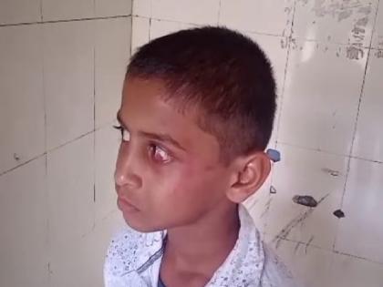 A student in Vashi was beaten, a case was registered against the teacher in kolhapur | Kolhapur: घरी जाण्यासाठी हट्ट धरल्याने वाशीतील विद्यार्थ्यास मारहाण, शिक्षकावर गुन्हा दाखल