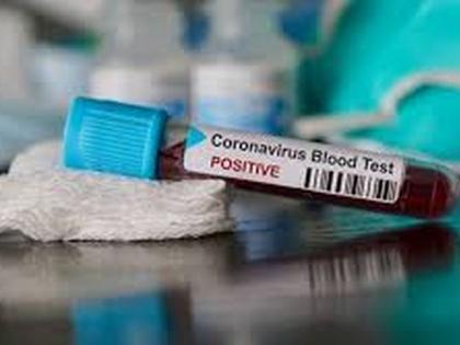 Coronavirus in Akola found 17 more positive patients | CoronaVirus in Akola आणखी १७ पॉझिटिव्ह रुग्ण आढळले