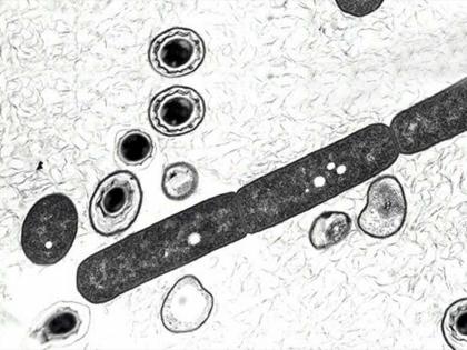 Anthrax Outbreak In Kerala Forest: All You Need To Know | कोरोनानंतर आता अँथ्रेक्सचा धोका, केरळमध्ये या भयानक आजाराचा उद्रेक