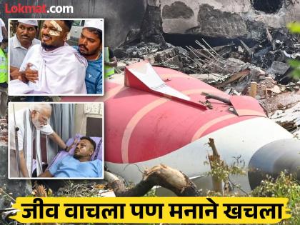 know how is Vishwas Kumar only survivor of ahmedabad air india plane crash sleepless nights does not talking to anyone | Vishwas Kumar : बोलणं बंद, झोप उडाली, मेंटली डिस्टर्ब... प्लेन क्रॅशमधून वाचलेल्या विश्वासची 'अशी' झालीय अवस्था know how is Vishwas Kumar only survivor of ahmedabad air india plane crash sleepless nights does not talking to anyone | Vishwas Kumar : बोलणं बंद, झोप उडाली, मेंटली डिस्टर्ब... प्लेन क्रॅशमधून वाचलेल्या विश्वासची 'अशी' झालीय अवस्था