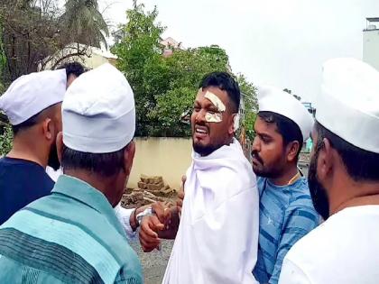 Ramesh survived the Ahmedabad plane crash, but now it's hard to even leave the house! Why? | अहमदाबादच्या विमान अपघातातून रमेश वाचले, पण आता घराबाहेर पडणंही झालं कठीण! कारण काय? 