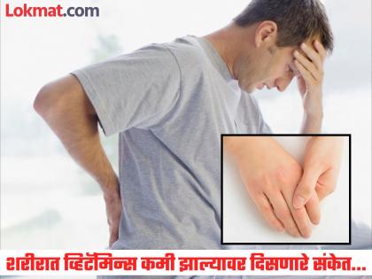 Nutritionist tells about vitamin deficiency symptoms and how to gain its | न्यूट्रिशनिस्टनुसार व्हिटॅमिन्स कमी झाल्यास शरीरावर दिसतात 'हे' संकेत, सोबतच सांगितले उपाय...