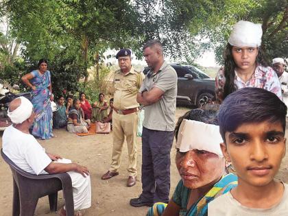 Robbers break into a house alone in Shivara, severely beat up women | रामराई गावालगतच्या शिवारात एकटे घर हेरून दरोडेखोरांचा हैदोस, महिलांना जबर मारहाण Robbers break into a house alone in Shivara, severely beat up women | रामराई गावालगतच्या शिवारात एकटे घर हेरून दरोडेखोरांचा हैदोस, महिलांना जबर मारहाण