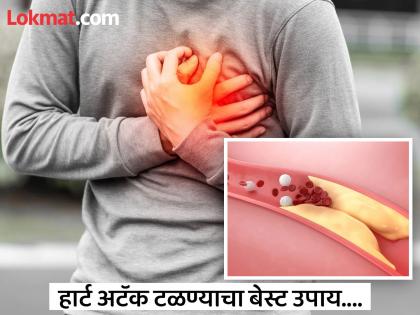 According to study health benefits of walking and exercise on weekends | वीकेंडला दोन दिवस करा 'हे' एक काम, शरीरातून कोलेस्ट्रॉल येईल बाहेर आणि रक्तप्रवाह होईल सुरळीत!