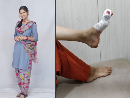 Even after injuries Pooja Birari Copleted Shooting | पायाला दुखापत होऊनही,पूजाने पूर्ण केले शूटिंग !