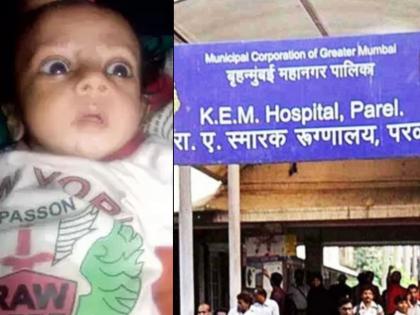 baby Prince who was injured in KEM fire passes away | केईएम रुग्णालयात भाजलेल्या प्रिन्सचा मृत्यू