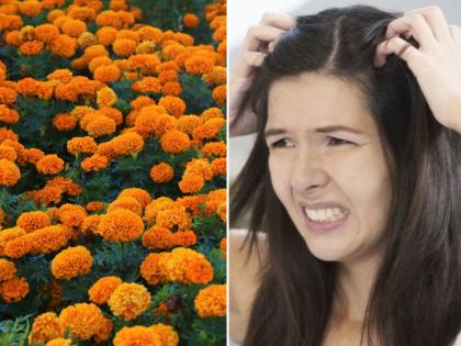 Know how to use of marigold for preventing hair problems | डोक्याला खाज येत असेल तर झेंडूच्या फुलांचा असा करा वापर 