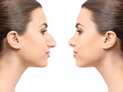 People do rhinoplasty to get killer look and attractive nose | किलर लूक मिळवण्यासाठी लोक करतात रायनोप्लास्टी, 'या' सर्जरीने नेमका कसा बदलतात लूक?