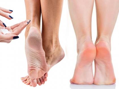 How to get relief from cracked heels by using Vaseline and Lemon myb | फक्त १० रूपयांचं वॅसलिन आणि लिंबू वापरून भेगा पडलेल्या टाचांपासून मिळवा सुटका